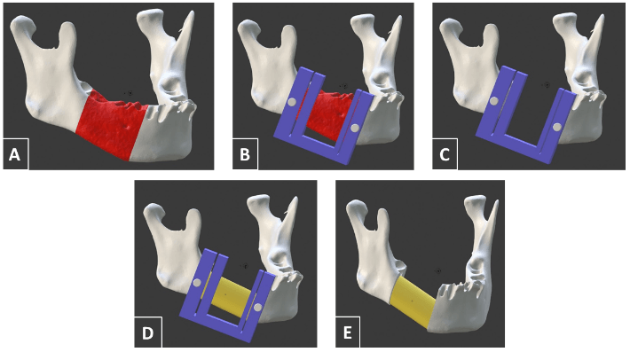 Medical Physics Lab - 3D Printing